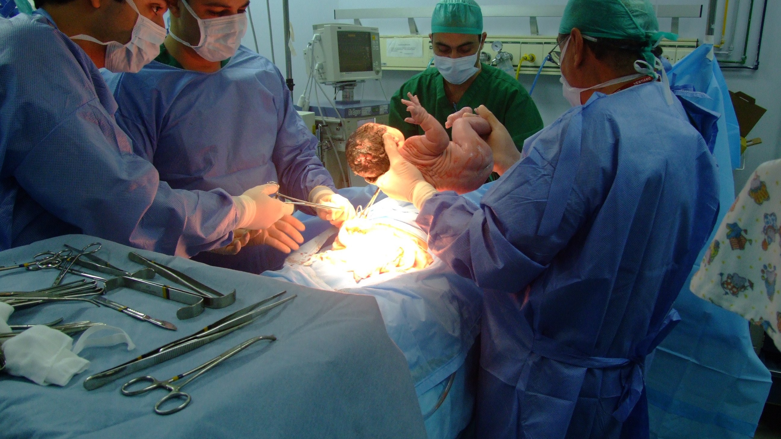 Patologiczne ciąża, opieka i roszczenie. Naturalny poród zamiast cesarki