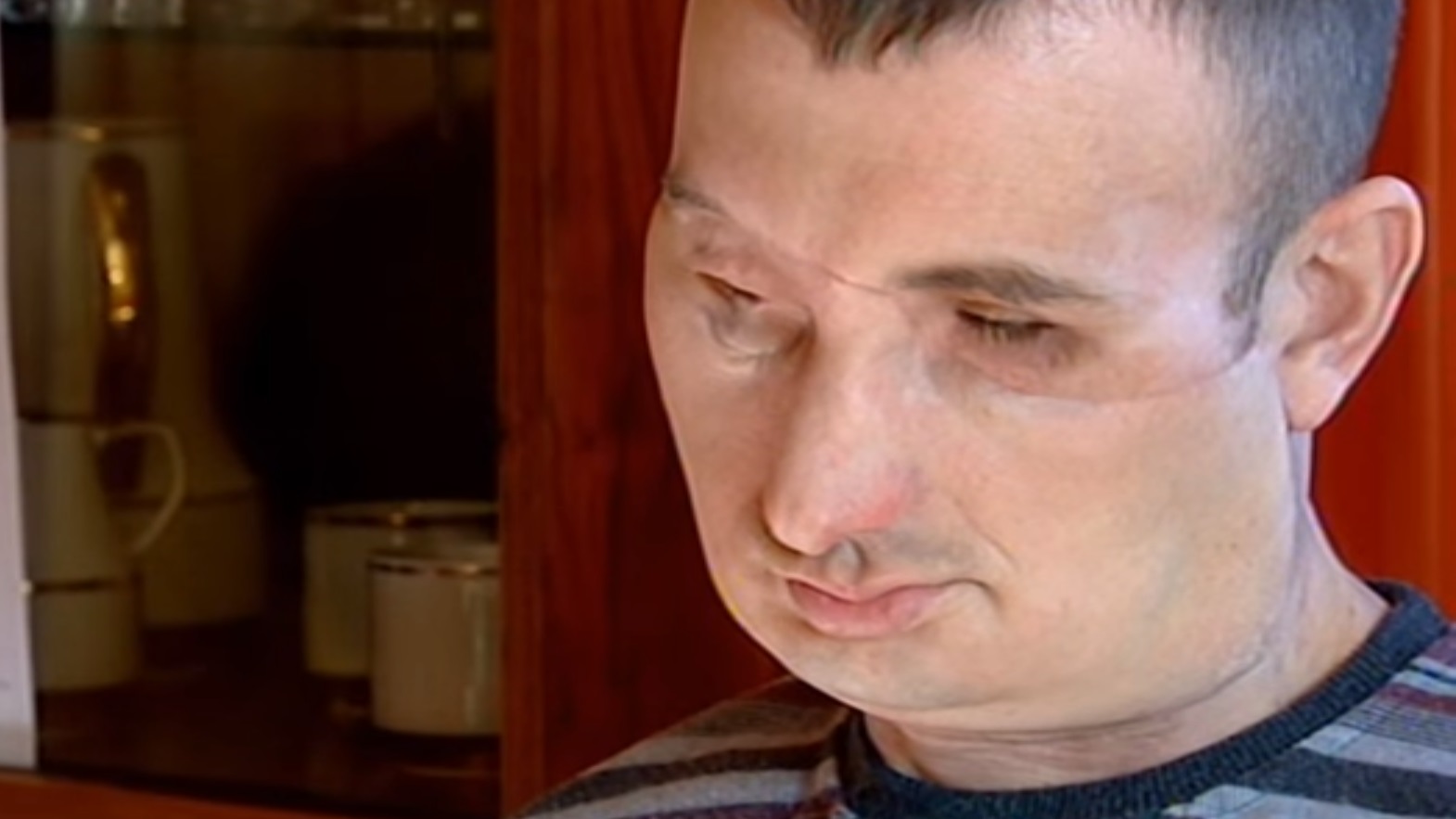 Gałki oczne wypadły mu na policzki. Historia Grzegorza Galasińskiego